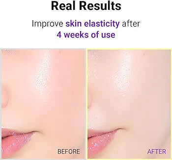 Isntree Hyper Retinol ex 1.0 Serum 20 ml Expiry 03 - 2027